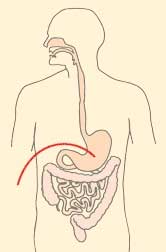 Gastrostomy feeding