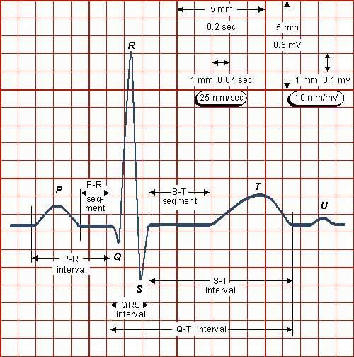 PQRST wave