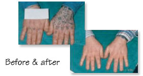 tattooed hands