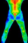 thermography heat map