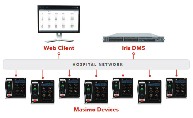 Masimo Iris DMS network