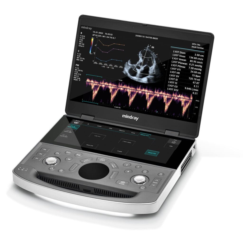 Mindray ME8 Ultrasound System