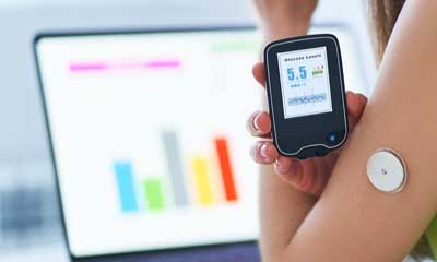 NICE has recommended the use of real-time continuous glucose monitoring (rtCGM)