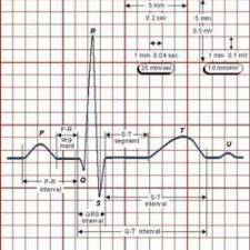 Electrical signals of the heart
